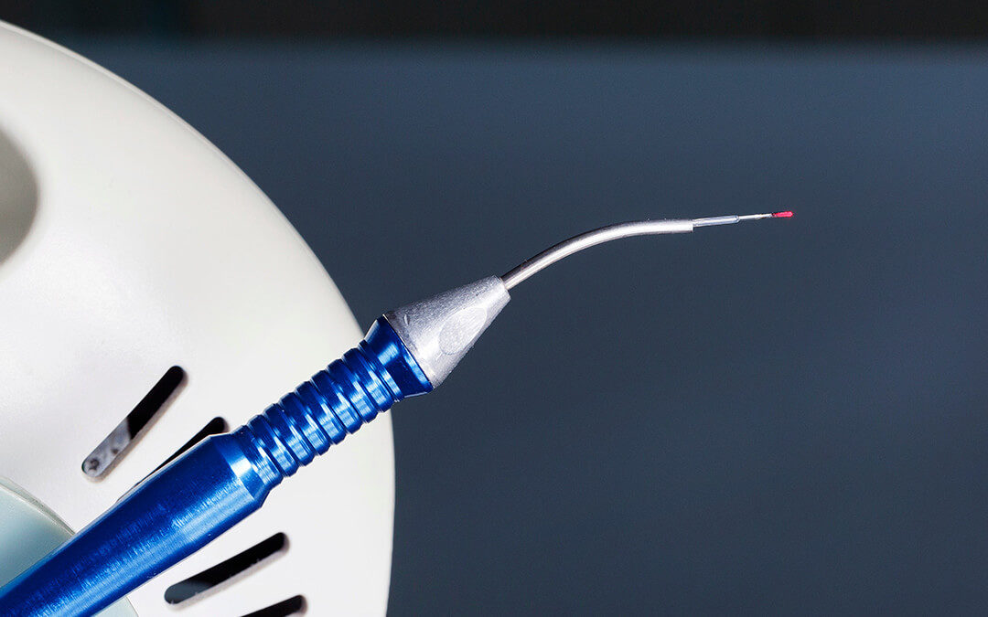 dental laser and special tip for surgical procedures