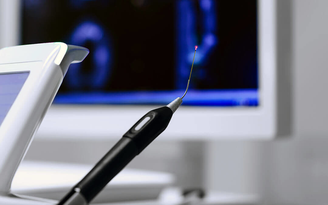 CO2 Lasers in Dentistry - dentistry tool